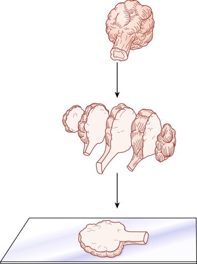 Figure 23-9 ▪