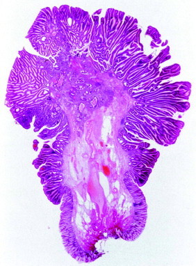 Figure 23-7 ▪