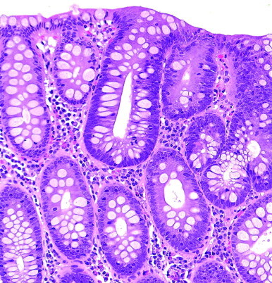 Figure 23-4 ▪
