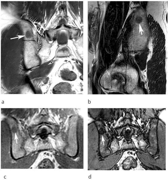 Figure 6.