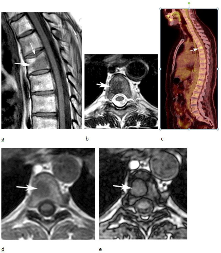 Figure 11.