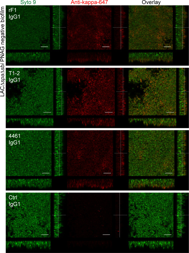 Figure 2—figure supplement 3.