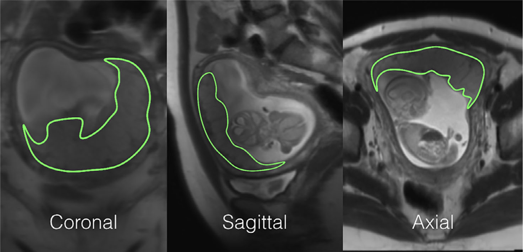 FIGURE 3: