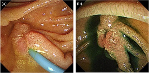 FIGURE 3