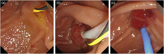 FIGURE 2