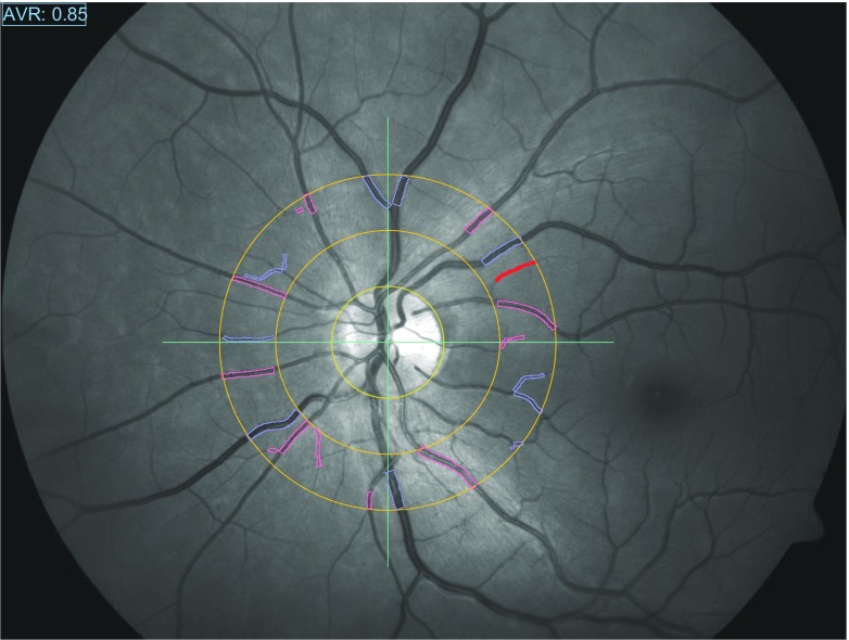 Fig. 3