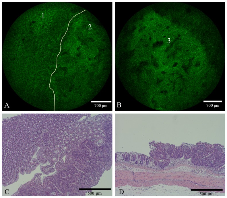 Fig. 13