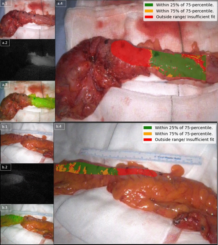 Fig. 4