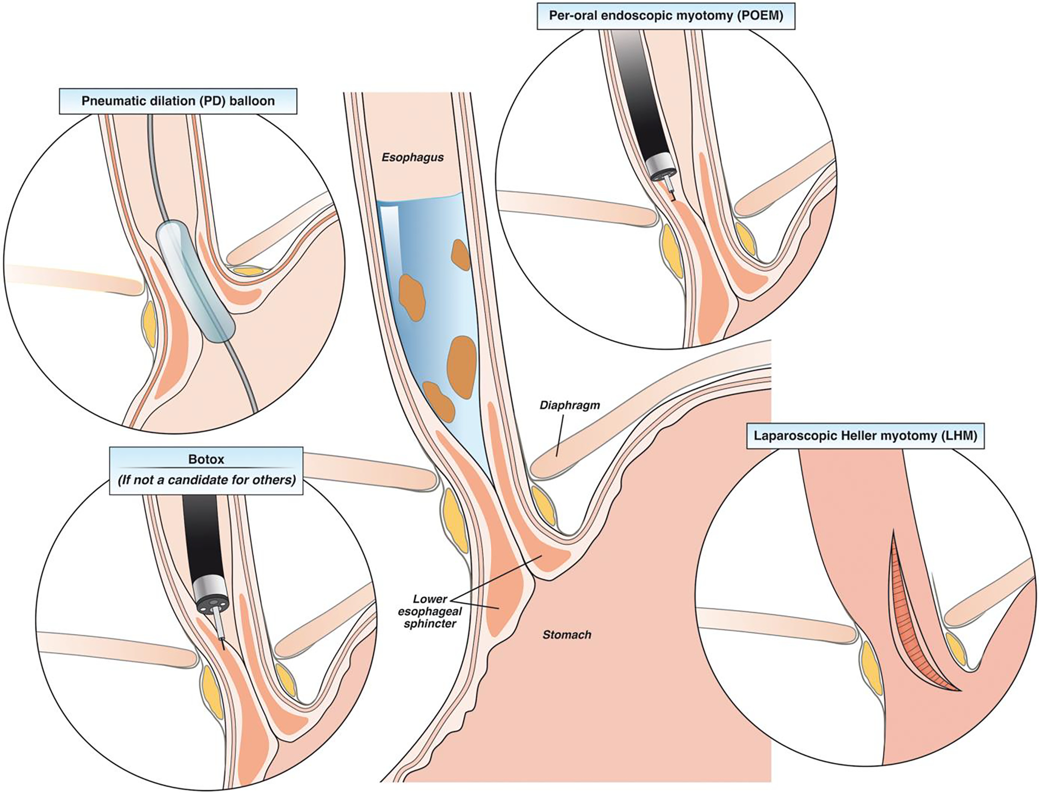 Figure 2: