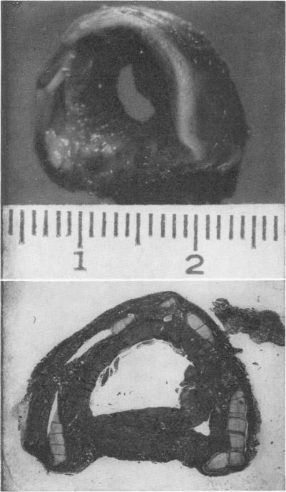 Fig. 1 (top)., Fig. 2 (bottom).