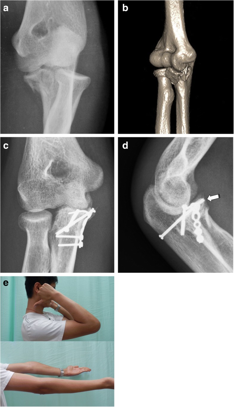 Fig. 4