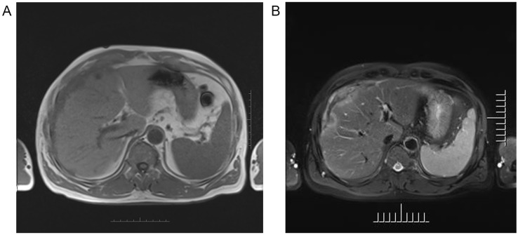 Figure 2