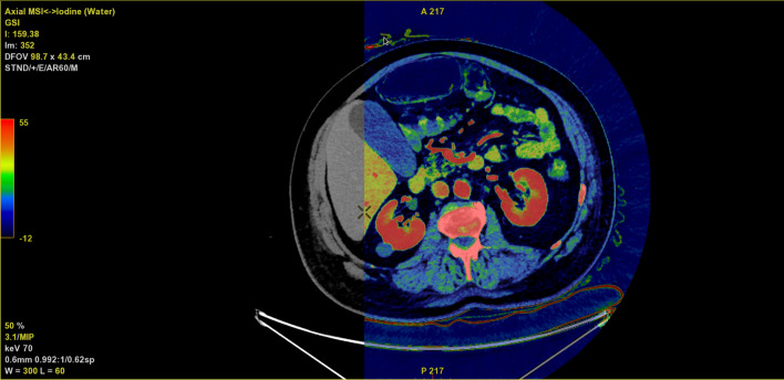 Fig. 1