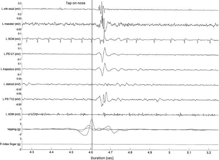 FIG 3