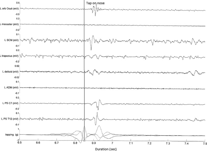 FIG 2