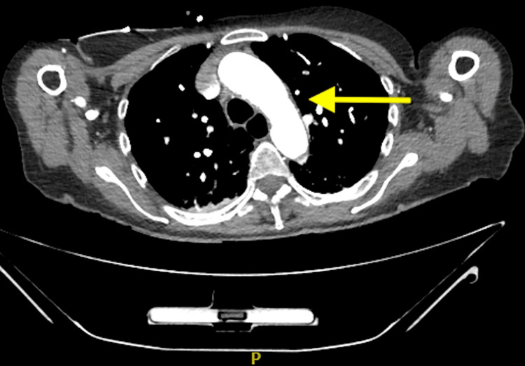 Figure 7