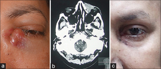 Figure 1: