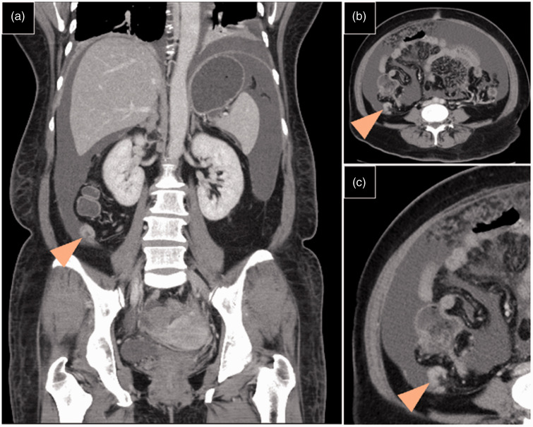 Figure 2.