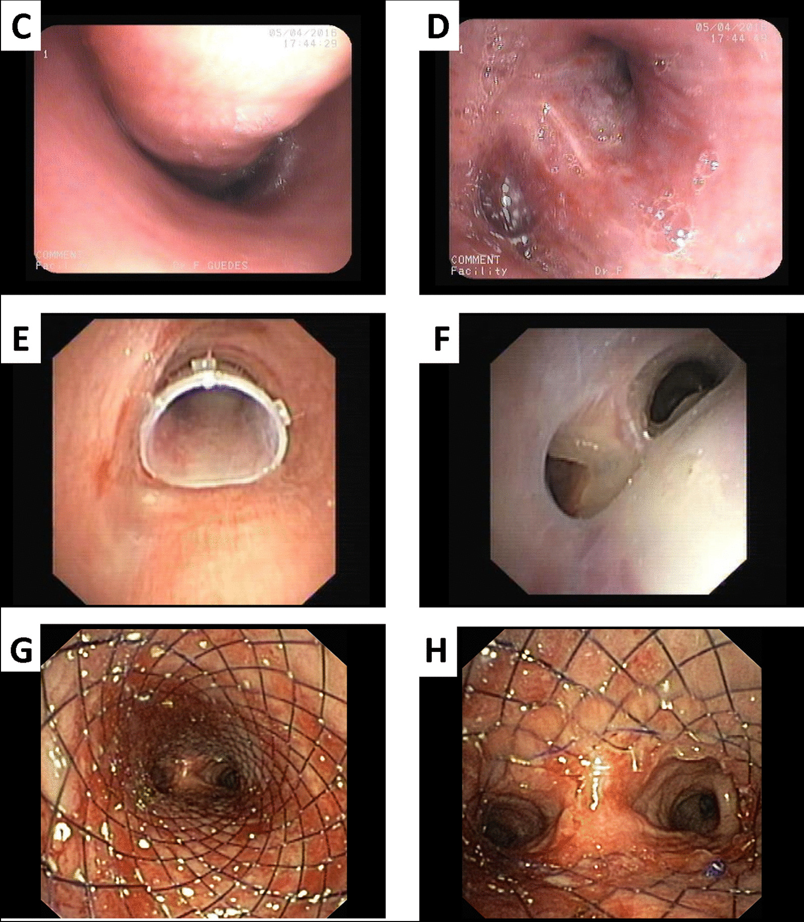 Fig. 4