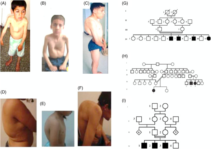 FIGURE 3