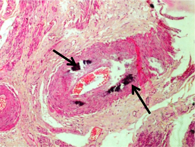 Fig. 1