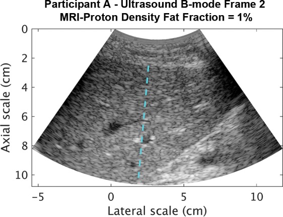 Figure 2c: