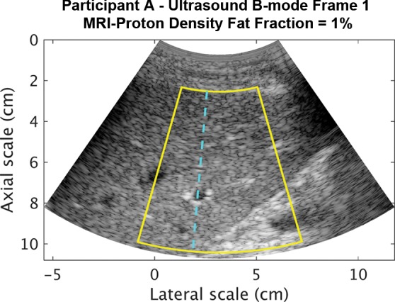 Figure 2a: