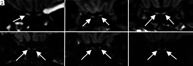 FIG 5.