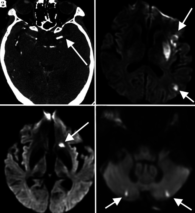 FIG 1.