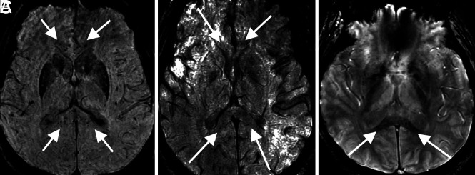 FIG 2.