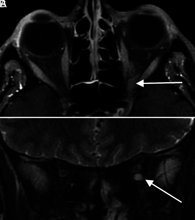 FIG 4.