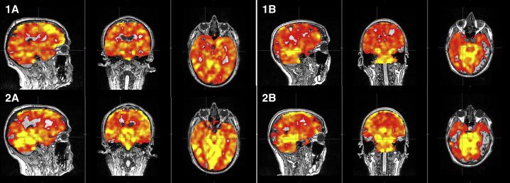 Fig. 1