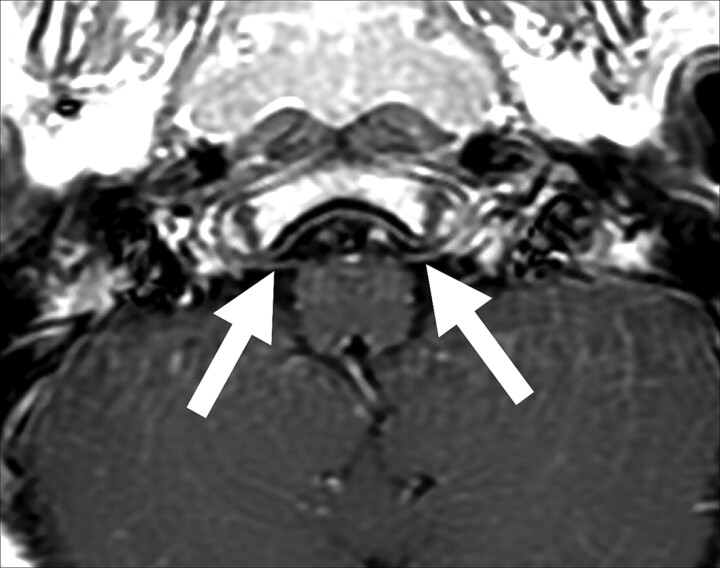 Fig 6.