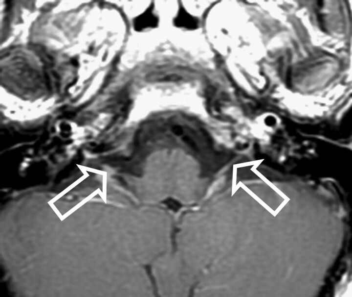 Fig 3.