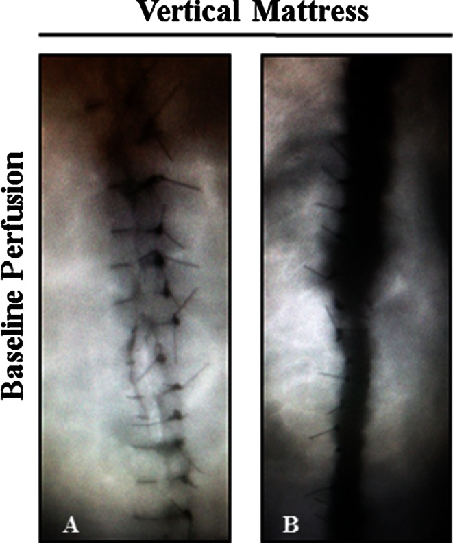 Fig. 4A–B