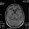Fig 1.