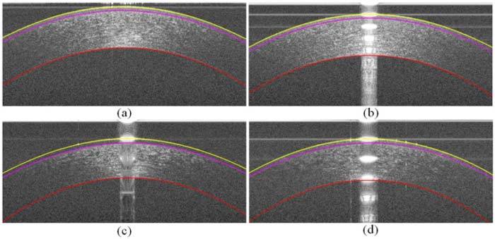 Fig. 14