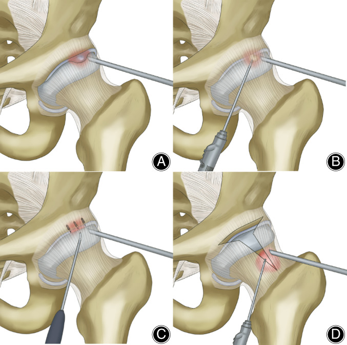 Fig. 5