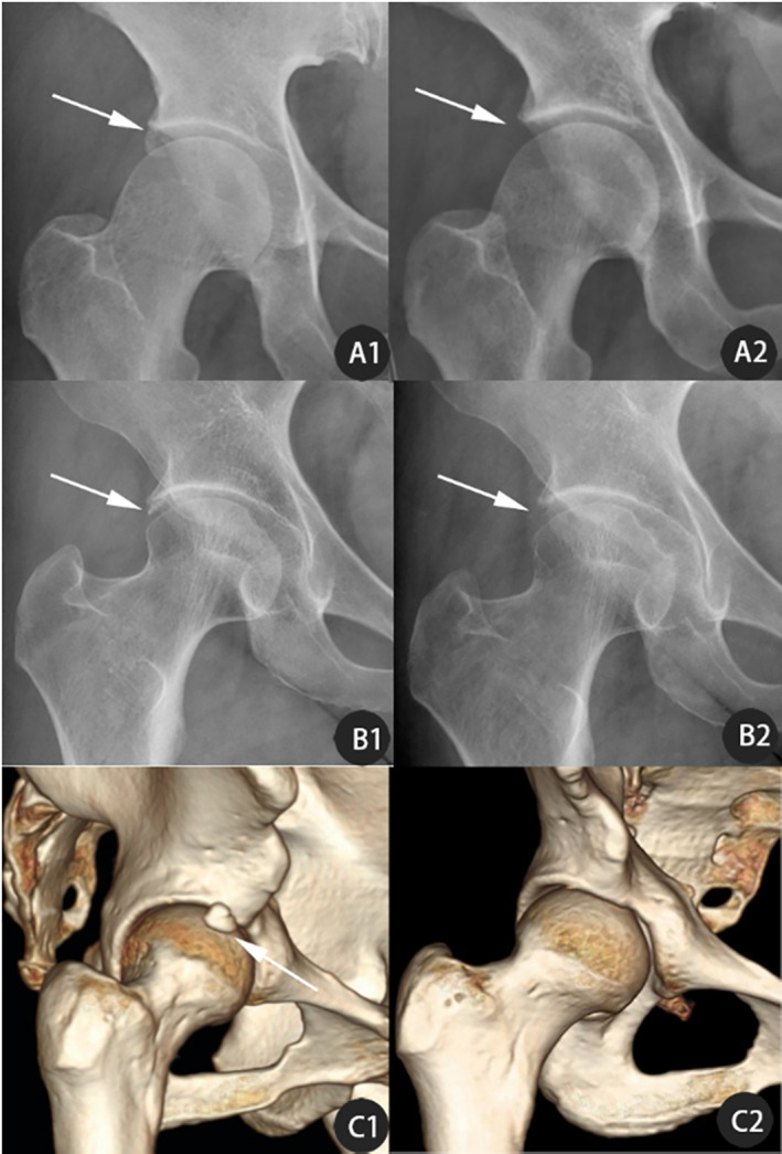 Fig. 2