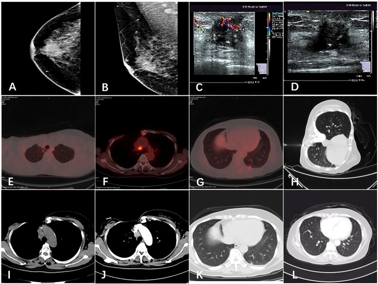 Figure 1