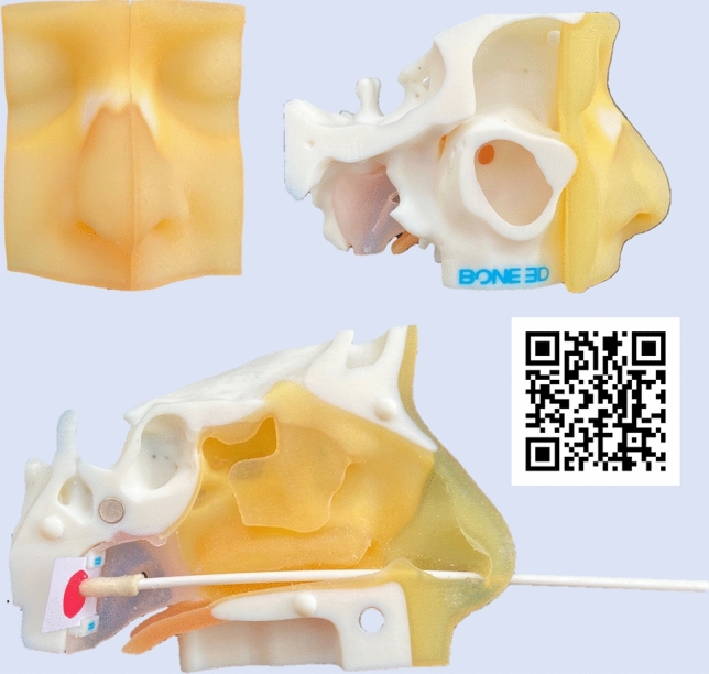 Fig. 1