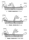 Figure 3)