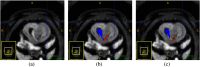 Fig. 10