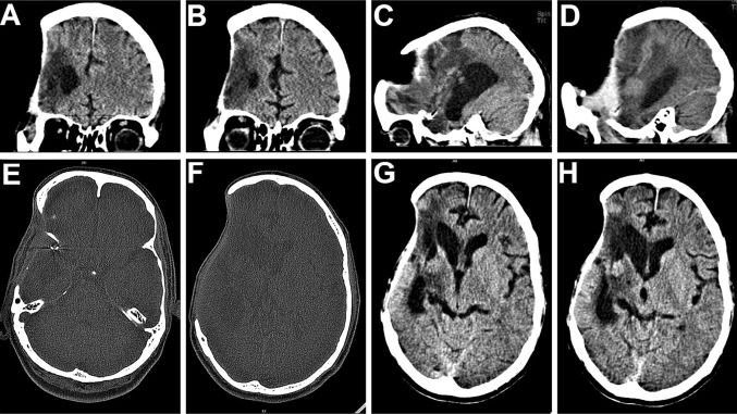 Fig. 2