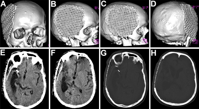 Fig. 4