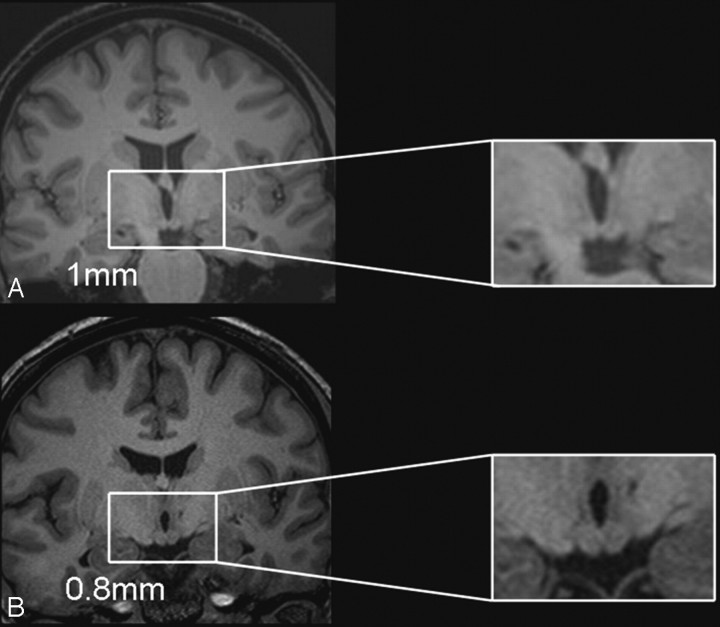 Fig 2.