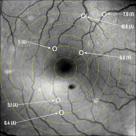 Figure 15