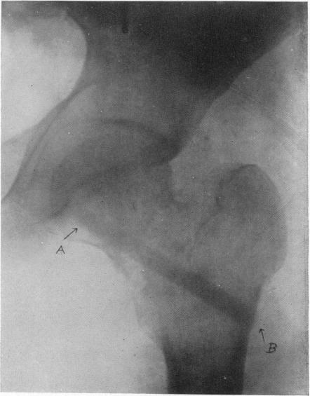 FIG. 9.