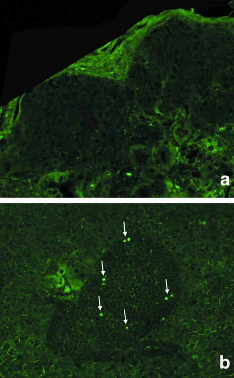 Fig. 13