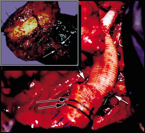 graphic file with name 15FF2.jpg